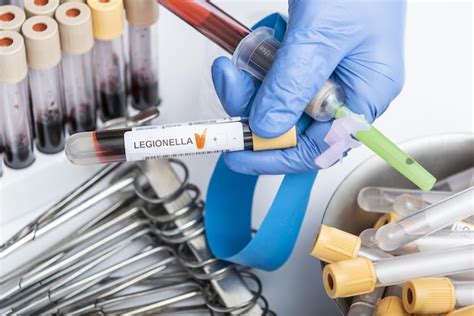 Premium Photo Scientists Hand Holding A Test Tube With Blood Sample