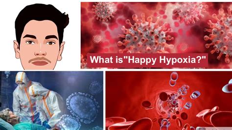 What Is Happy Hypoxia Why There Is A Sudden Drop In Oxygen Level