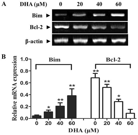 Involvement Of The Mitochondrial Pathway And Bim Bcl 2 Balance In