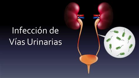 Infecci N De V As Urinarias Medicoblastita Udocz