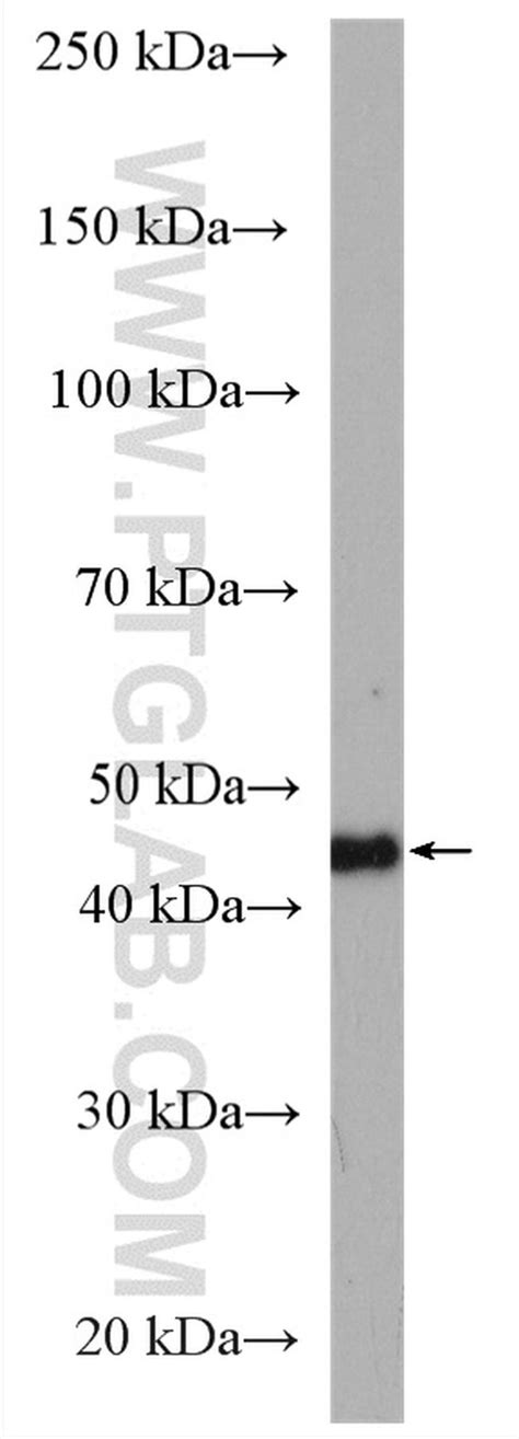 Hla Class I Abc Polyclonal Antibody 15240 1 Ap