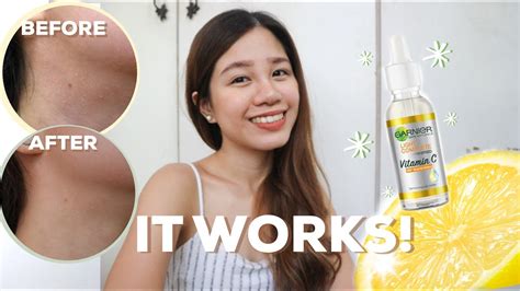 Garnier Vitamin C Serum Review 3 Days 7 Days Results Philippines