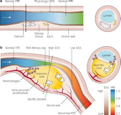 Coronary Angiogram - Expert Treatment | Levy Heart Health