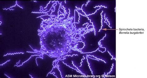 Borrelia Burgdorferi Bacteria Microscope