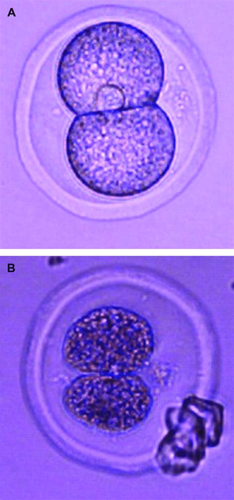 Morphology Of Murine Embryos After Vitrification A Intact B