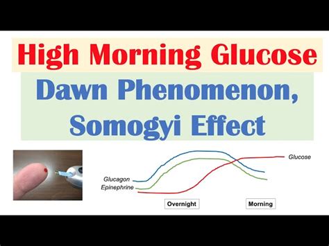 High Early Morning Glucose Dawn Phenomenon Somogyi Effect E