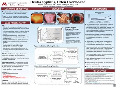 (PDF) Ocular Syphilis, Often Overlooked