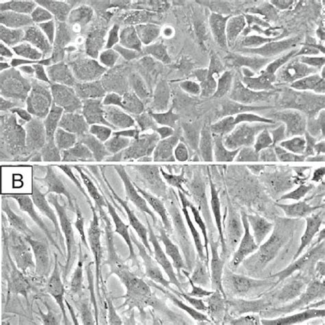 Morphology Of Human Articular Chondrocytes Grown In Monolayer Culture