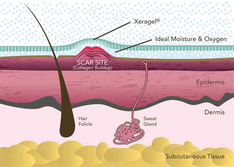 Αναπλαστική γέλη σιλικόνης Xeragel – DermaPharm Shop