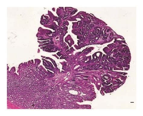 Af Macroscopic Observation Of Normal Colon Tissue Colorectal