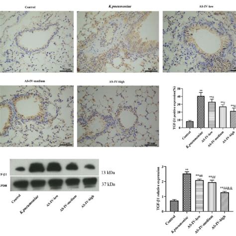 A Expression Pattern Of Transforming Growth Factor Tgf B In Lung