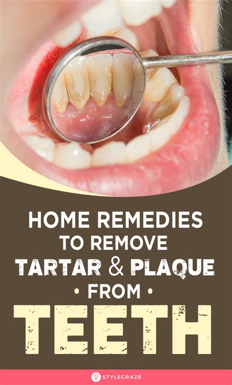 How To Remove Tartar From Retainer In 2023 – MartLabPro