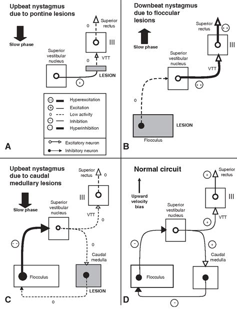 Vertical Nystagmus Semantic Scholar