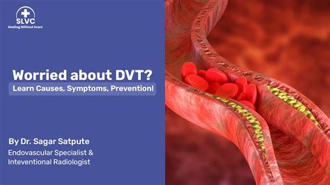 Deep Vein Thrombosis Dvt How It Occurs Symptoms Diagnosis And Treatment