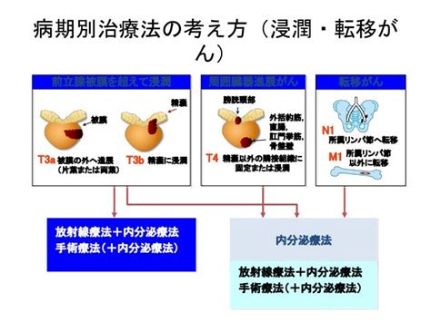 前立腺癌の診断，治療 特にロボット手術について（順天堂大学泌尿器科，堀江重郎）