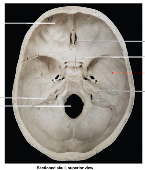 Skull Superior View Diagram Quizlet