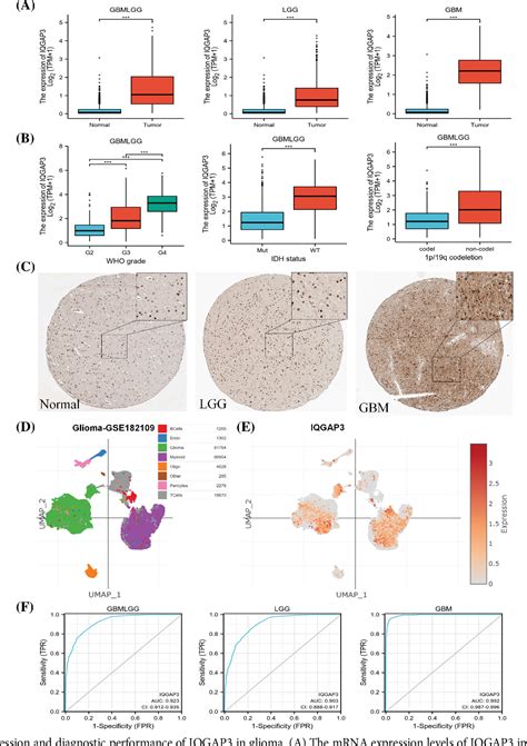 Figure 2 From Iqgap3 Promotes The Progression Of Glioma As An Immune