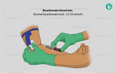 बाइकार्बोनेट परीक्षण क्या है, खर्च, कब, क्यों, कैसे होता है - Bicarbonate Test normal range ...