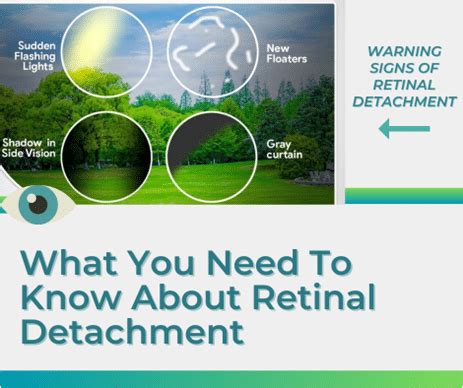 What You Need To Know About Retinal Detachment Midwest Eye Center