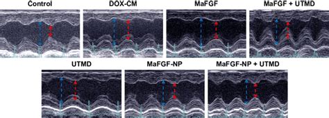 Echocardiograms Of The Left Ventricle In M Mode Notes The Left