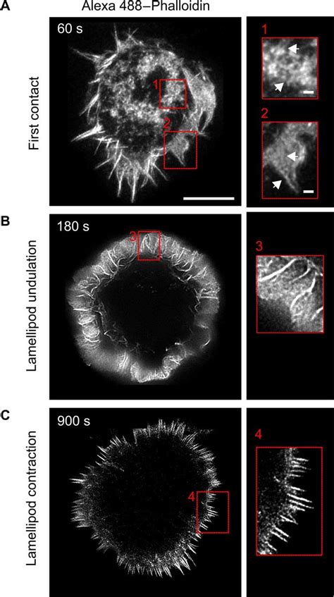 Nanoscopic Details Of Global Actin Cytoskeleton Rearrangements During T