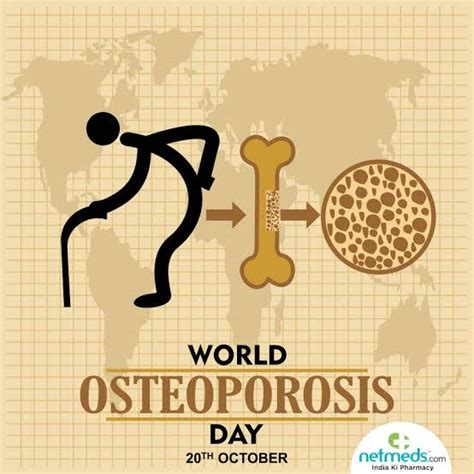 World Osteoporosis Day October 20 2022 History Significance Worldtimeshindi