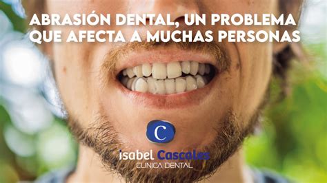 Abrasión Dental Un Problema Muy Común En Nuestros Días Clinica