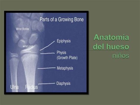 Osteomielitis Artritis Séptica Y Sinovitis En Pediatría Ppt