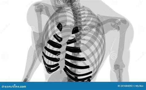 Human Skeleton Anatomy Costal Cartilage 3D Rendering Stock Illustration - Illustration of pain ...