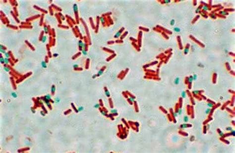 Endospore Staining - Principle, Procedure & Result Interpretation....