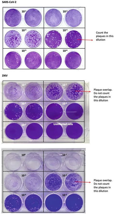 Examples Of Plaque Assay Plates Infected With Zikv And Sars Cov