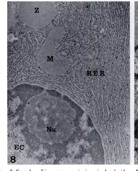 Figure 1 From Ultrastructural Localization Of Nuclei Acids By The Use