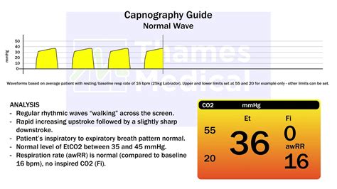 Capnography Waveforms Normal Waveforms Youtube