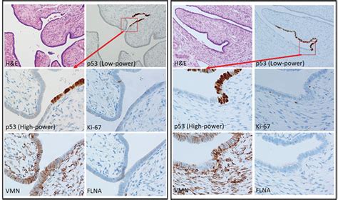 Histological And Immunohistochemical Features Of Fallopian Tube