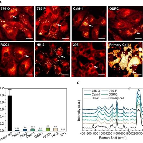 Primary Cancer Cell As An Appropriate Model For The Study Of