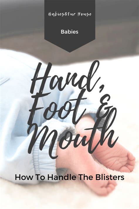 Hand foot and mouth disease controlling blisters – Artofit