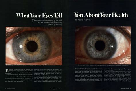 What Your Eyes Tell You About Your Health Esquire January 1978