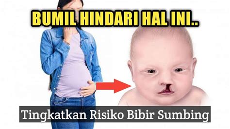 HAL HAL YANG BISA MENINGKATKAN RISIKO BAYI LAHIR DENGAN BIBIR SUMBING