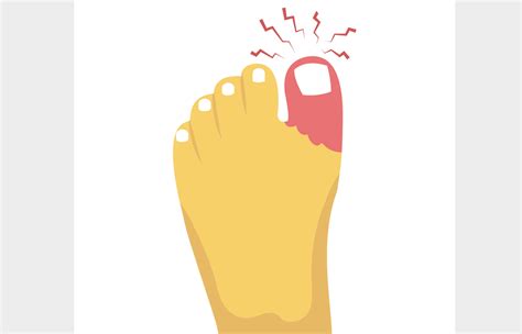 Causes Of Sharp Stabbing Pain In The Big Toe Newman Feet