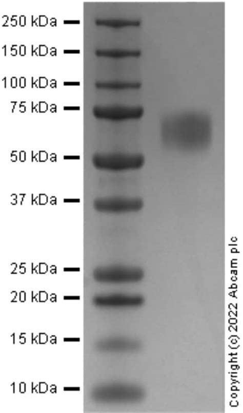 Recombinant Human FGFR2 protein Active ab287927 アブカム