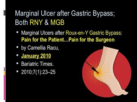 Marginal Ulcer Gastric Bypass