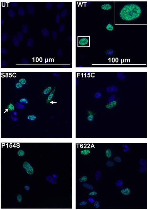 Expression Of Matrin 3 Yfp Fusion Proteins In Cho Cells Cells Were