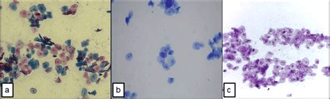 Normal Oral Smear A Papanicolaou Staining B Apt Dr Gan