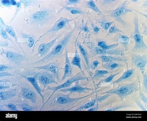 HeLa cervical cancer cells, stained with Coomassie blue, under ...