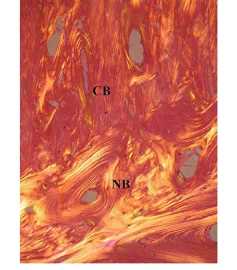 A Hematoxylin And Eosin Stained Section Using Polarized Light Is Shown