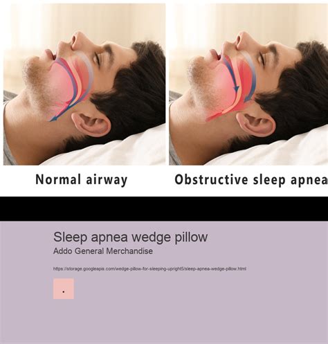 sleep apnea wedge pillow