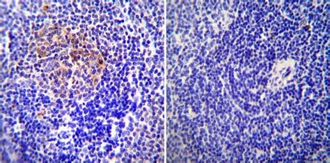 Icam Monoclonal Antibody E B Invitrogen G Unconjugated