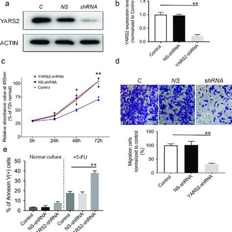 Knockdown Of Yars Inhibited Crc Cell Proliferation And Migration And