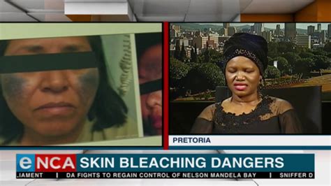 Skin Bleaching Dangers Youtube