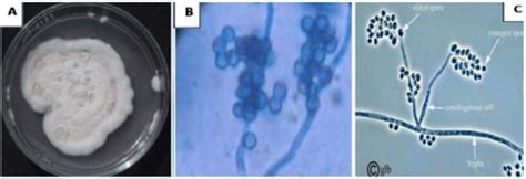 Macroscopic A And Microscopic B Characters Of Isolated Beauveria Download Scientific